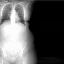 x-ray of body