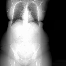x-ray of body