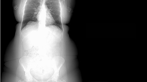 x-ray of body