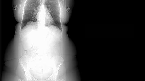 x-ray of body
