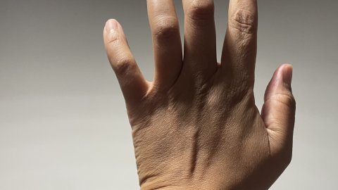Erinma's unproductive left hand