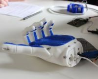Open Bionics prosthetic hand