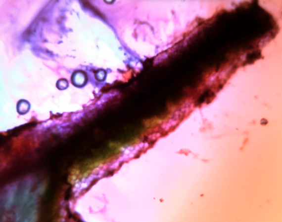 A microscopic and multi coloured image of a long black item, surrounded by bubbles, pink and orange blurs